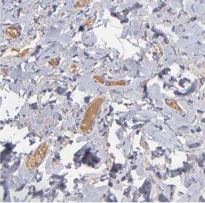 Immunohistochemistry-Paraffin: Factor XIIIb Antibody [NBP1-89811]