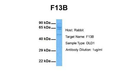 Western Blot: Factor XIIIb Antibody [NBP1-58012]