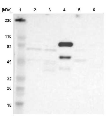 Western Blot: Factor XIIIb Antibody [NBP1-89811]