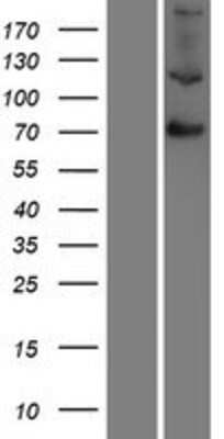 Western Blot: Factor XIIIb Overexpression Lysate [NBP2-10788]