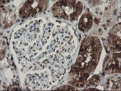Immunohistochemistry: Factor XIIIa Antibody (OTI6F5) [NBP2-45562]