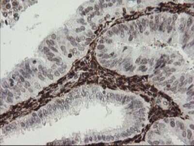 Immunohistochemistry: Factor XIIIa Antibody (OTI6F5) [NBP2-45562]