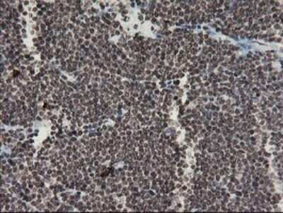 Immunohistochemistry: Factor XIIIa Antibody (OTI6F5) [NBP2-45562]