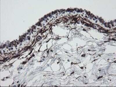 Immunohistochemistry: Factor XIIIa Antibody (OTI6F5) [NBP2-45562]