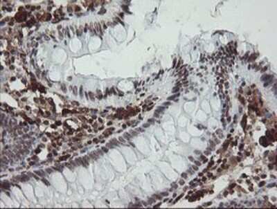 Immunohistochemistry: Factor XIIIa Antibody (OTI6F5) [NBP2-45562]