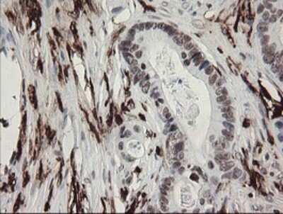 Immunohistochemistry: Factor XIIIa Antibody (OTI6F5) [NBP2-45562]