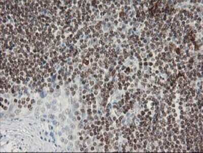 Immunohistochemistry: Factor XIIIa Antibody (OTI6F5) [NBP2-45562]
