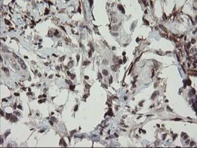 Immunohistochemistry: Factor XIIIa Antibody (OTI6F5) [NBP2-45562]