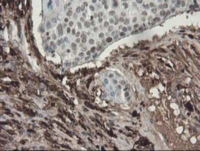 Immunohistochemistry: Factor XIIIa Antibody (OTI6F5) [NBP2-45562]