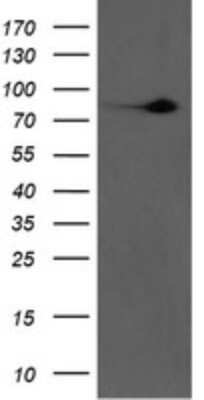 Western Blot: Factor XIIIa Antibody (OTI6F5) [NBP2-45562]