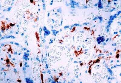 Immunohistochemistry-Paraffin: Factor XIIIa Antibody (AC-1A1) [NB100-696]