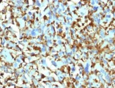 Immunohistochemistry-Paraffin: Factor XIIIa Antibody (F13A1/1448) - Azide and BSA Free [NBP2-59605]