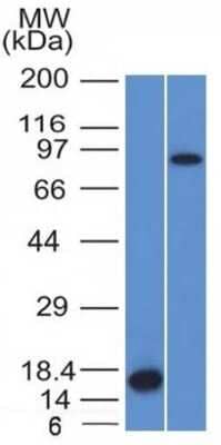 Western Blot: Factor XIIIa Antibody (F13A1/1448)Azide and BSA Free [NBP2-59605]