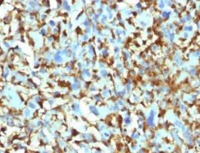 Immunohistochemistry-Paraffin: Factor XIIIa Antibody (F13A1/1448) [NBP2-59604]