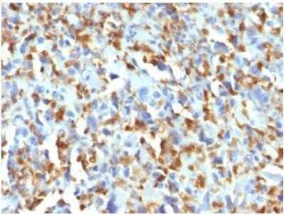 Immunohistochemistry-Paraffin: Factor XIIIa Antibody (F13A1/1683) - Azide and BSA Free [NBP2-59607]