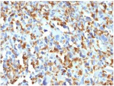 Immunohistochemistry-Paraffin: Factor XIIIa Antibody (F13A1/1683) [NBP2-59606]