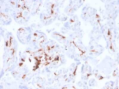 Immunohistochemistry-Paraffin: Factor XIIIa Antibody (F13A1/3772R) - Azide and BSA Free [NBP3-08933]