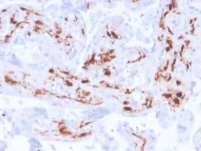 Immunohistochemistry-Paraffin: Factor XIIIa Antibody (F13A1/3772R) - Azide and BSA Free [NBP3-08933]