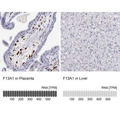 Immunohistochemistry-Paraffin: Factor XIIIa Antibody [NBP1-83938]