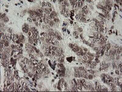 Immunohistochemistry: Factor XIIIa Antibody (OTI6F5) - Azide and BSA Free [NBP2-70696]