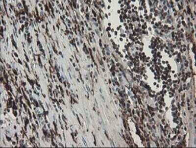 Immunohistochemistry: Factor XIIIa Antibody (OTI6F5) - Azide and BSA Free [NBP2-70696]