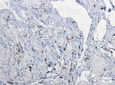 Immunohistochemistry-Paraffin: Factor XIIIa Antibody (S06-3A7) [NBP3-19500]