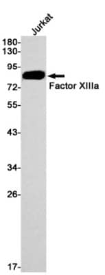 Western Blot: Factor XIIIa Antibody (S06-3A7) [NBP3-19500]