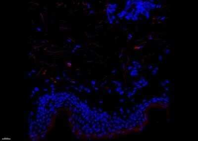 Immunohistochemistry-Frozen: Factor XIIIa Antibody (SPM180) - Azide and BSA Free [NBP2-54480]