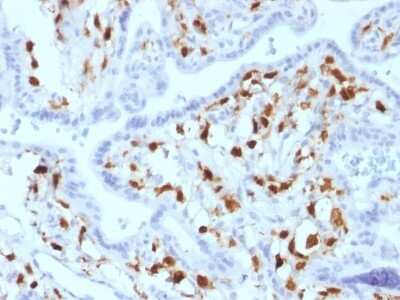 Immunohistochemistry-Paraffin: Factor XIIIa Antibody (SPM180) [NBP2-53238]