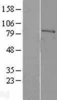 Western Blot: Factor XIIIa Overexpression Lysate [NBL1-10406]