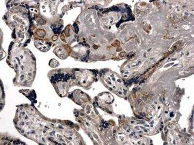 Immunohistochemistry-Paraffin: Fas/TNFRSF6/CD95 Antibody (MM0041-12J3) - Azide and BSA Free [NB110-61007]