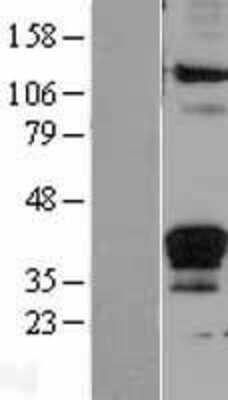 Western Blot: Fas Ligand/TNFSF6 Overexpression Lysate [NBL1-10600]