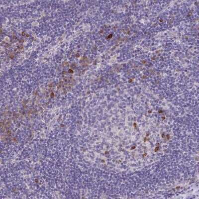 Immunohistochemistry-Paraffin: Fas Ligand/TNFSF6 Antibody [NBP2-49160]