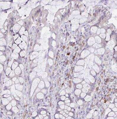 Immunohistochemistry-Paraffin: Fas Ligand/TNFSF6 Antibody [NBP2-49160]