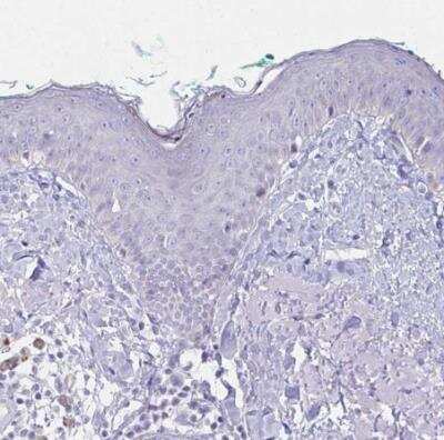 Immunohistochemistry-Paraffin: Fas Ligand/TNFSF6 Antibody [NBP2-49160]