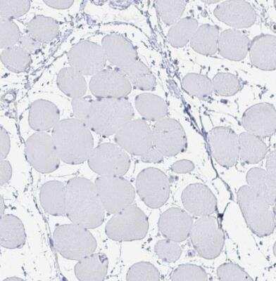 Immunohistochemistry-Paraffin: Fas Ligand/TNFSF6 Antibody [NBP2-49160]