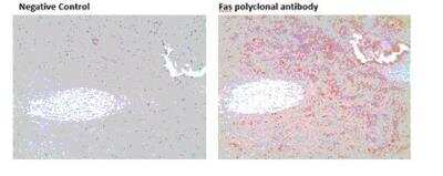 Immunohistochemistry-Paraffin: Fas/TNFRSF6/CD95 Antibody - BSA Free [NB120-13550]