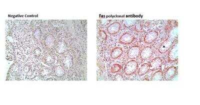 Immunohistochemistry-Paraffin: Fas/TNFRSF6/CD95 Antibody - BSA Free [NB120-13550]
