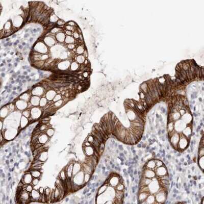 Immunohistochemistry-Paraffin: Fas/TNFRSF6/CD95 Antibody [NBP1-89034]
