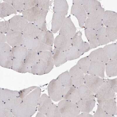 Immunohistochemistry-Paraffin: Fas/TNFRSF6/CD95 Antibody [NBP1-89034]