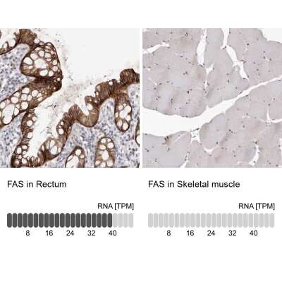 Immunohistochemistry-Paraffin: Fas/TNFRSF6/CD95 Antibody [NBP1-89034]