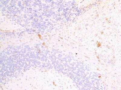 Immunohistochemistry-Paraffin: Fascin 2 Antibody [NBP1-06036]