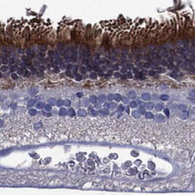 Immunohistochemistry-Paraffin: Fascin 2 Antibody [NBP3-17368]