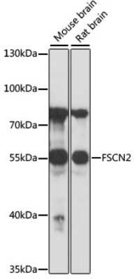 Western Blot: Fascin 2 AntibodyAzide and BSA Free [NBP3-03441]