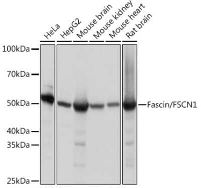 Western Blot: Fascin Antibody (1B3V6) [NBP3-16828]