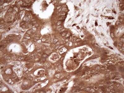 Immunohistochemistry: Fascin Antibody (OTI3B4) [NBP2-45737]