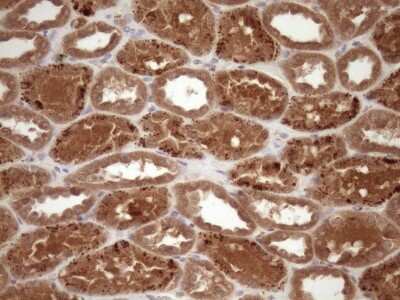 Immunohistochemistry: Fascin Antibody (OTI3B4) [NBP2-45737]