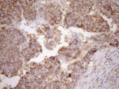 Immunohistochemistry: Fascin Antibody (OTI3B4) [NBP2-45737]