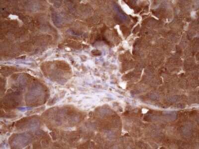 Immunohistochemistry: Fascin Antibody (OTI3B4) [NBP2-45737]
