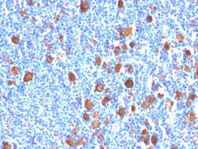 Immunohistochemistry-Paraffin: Fascin Antibody (FSCN1/416) - IHC-Prediluted [NBP2-48310]